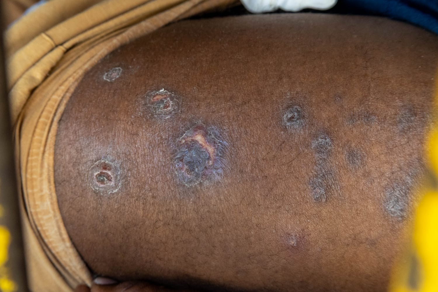 Crise Humanitária no Cárcere Paulista: Uma Morte a Cada 19 Horas e o Colapso da Saúde Pública