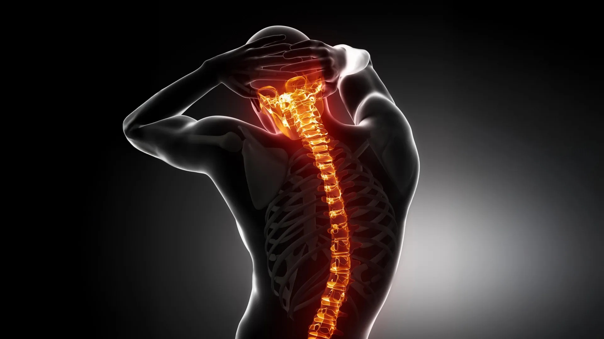 Além da Cirurgia: Medicamento de Osteoporose Aponta Caminho Para Tratar Dor Crônica na Coluna