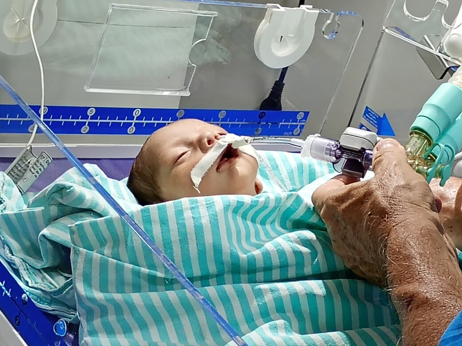 Transferência aérea Urgente de bebê com malformação cardíaca