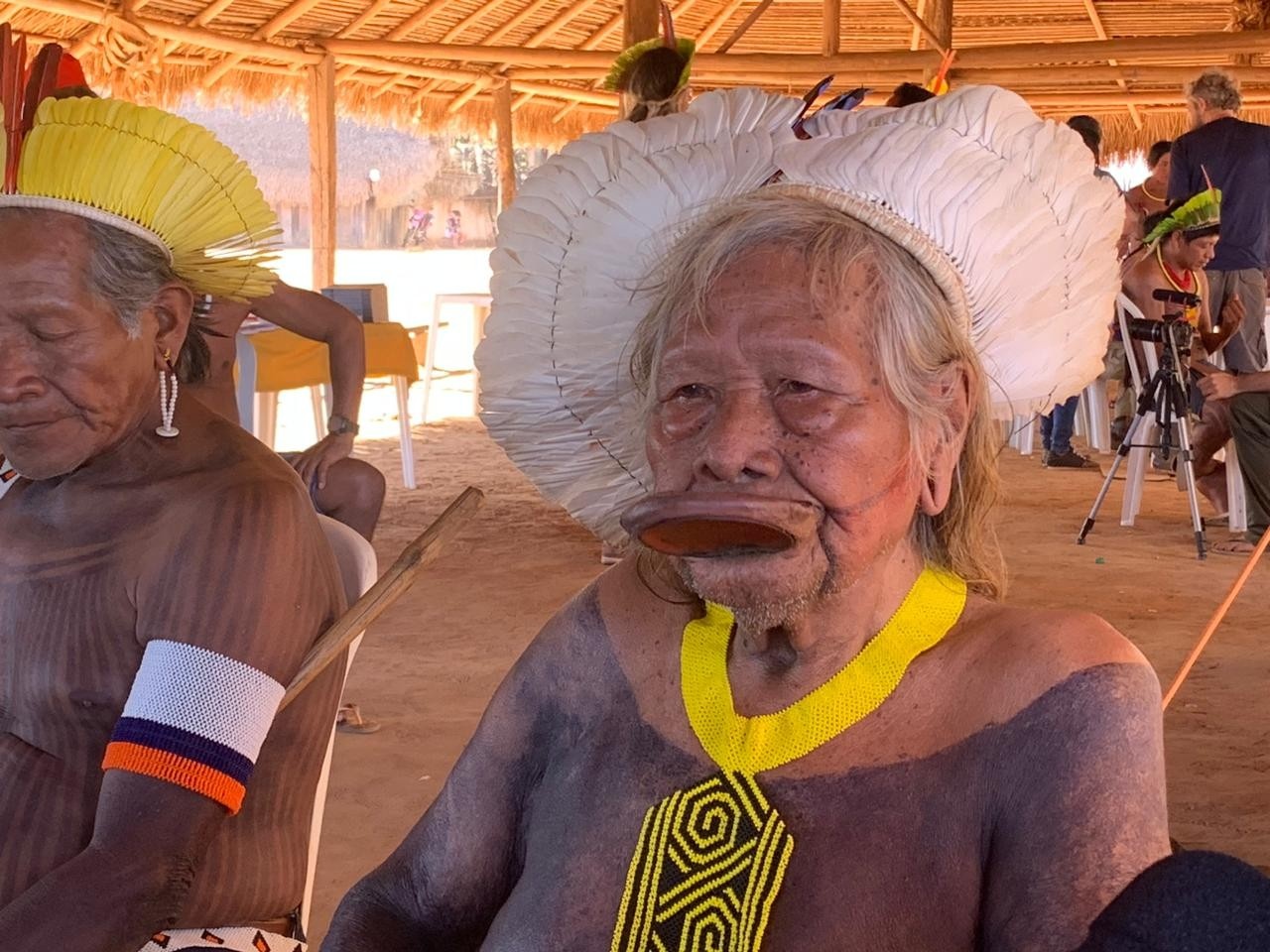 A Saúde de Raoni: Estabilidade Clínica e o Cenário Ampliado da Liderança Indígena no Xingu