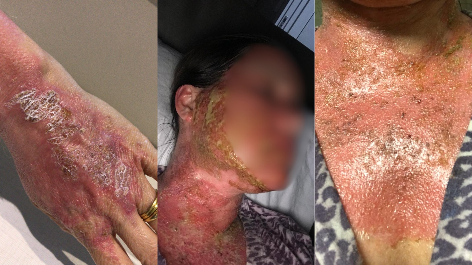 Condenação por Peeling: As Lições Jurídicas e Éticas que Redefinem a Busca por Estética no Paraná