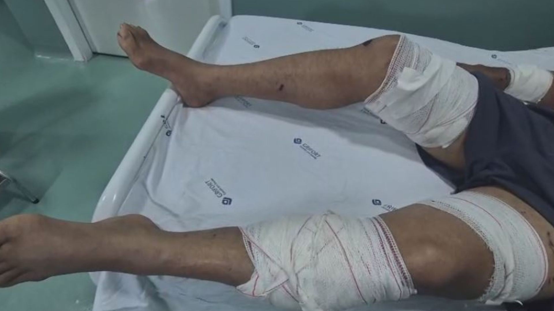 Comerciante é internado após ser atacado por três pitbulls em Oiapoque, Amapá