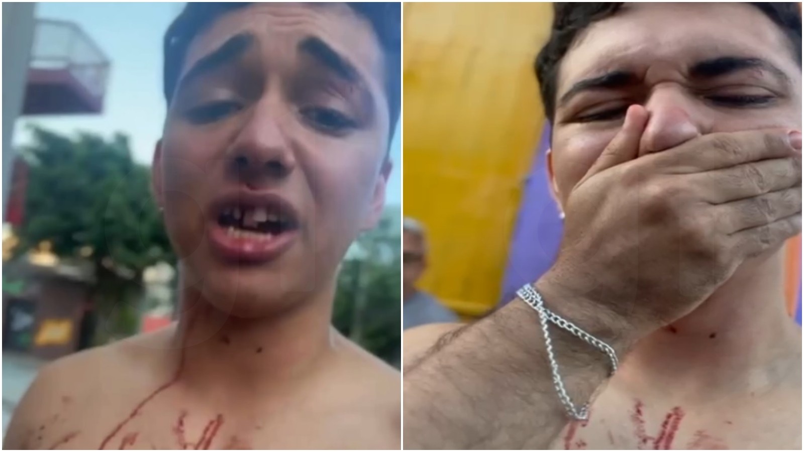 Agressão em Boate na Capital Cearense: O Preço da Insegurança e a Urgência da Responsabilidade Civil