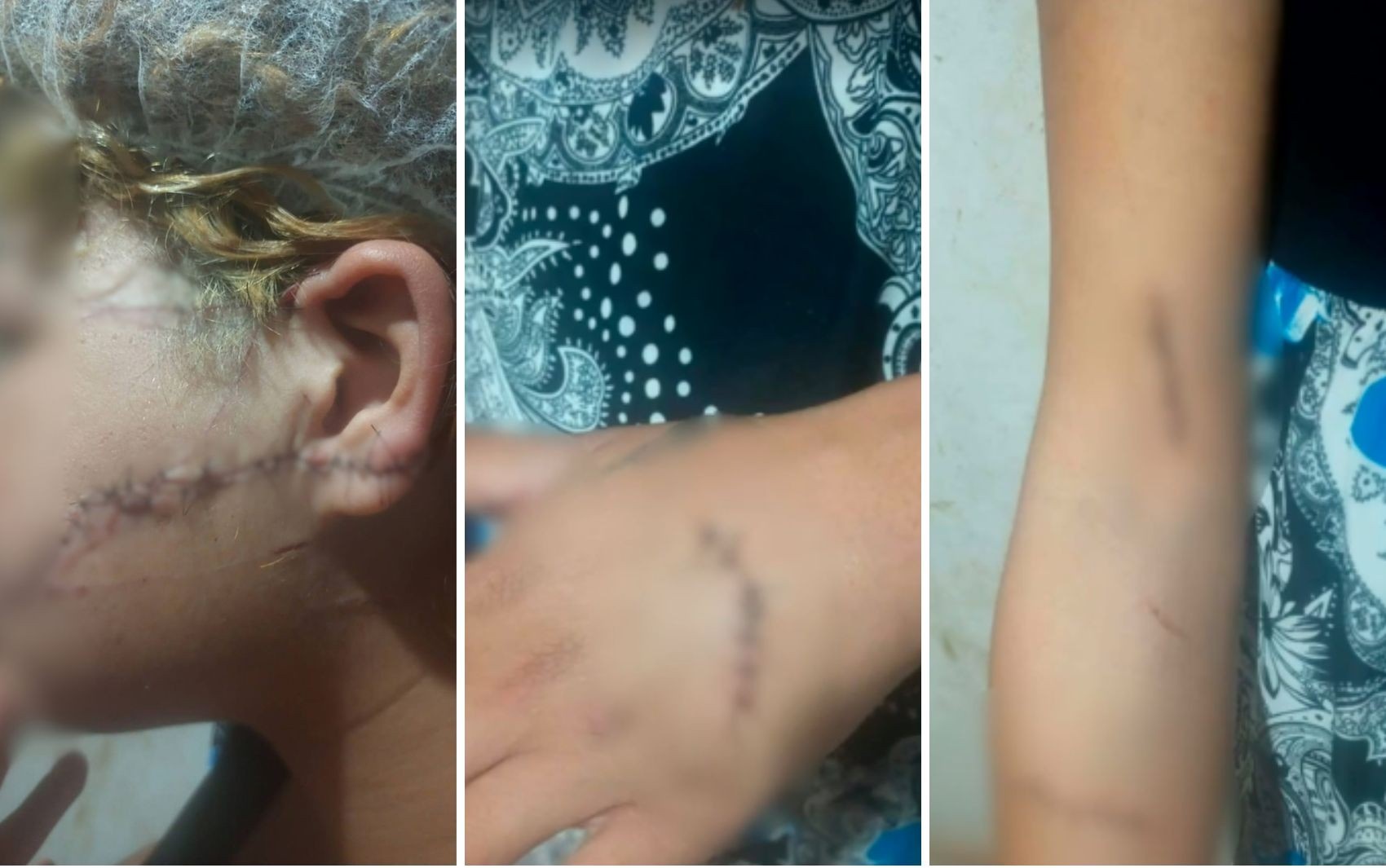 Ex-Marido é preso por tentar matar e Agredir ex-companheiras