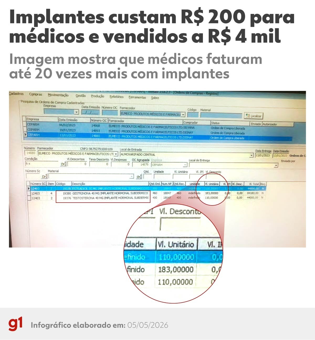Implantes Hormonais: A Sombra da Indústria da Estética e Saúde no Brasil