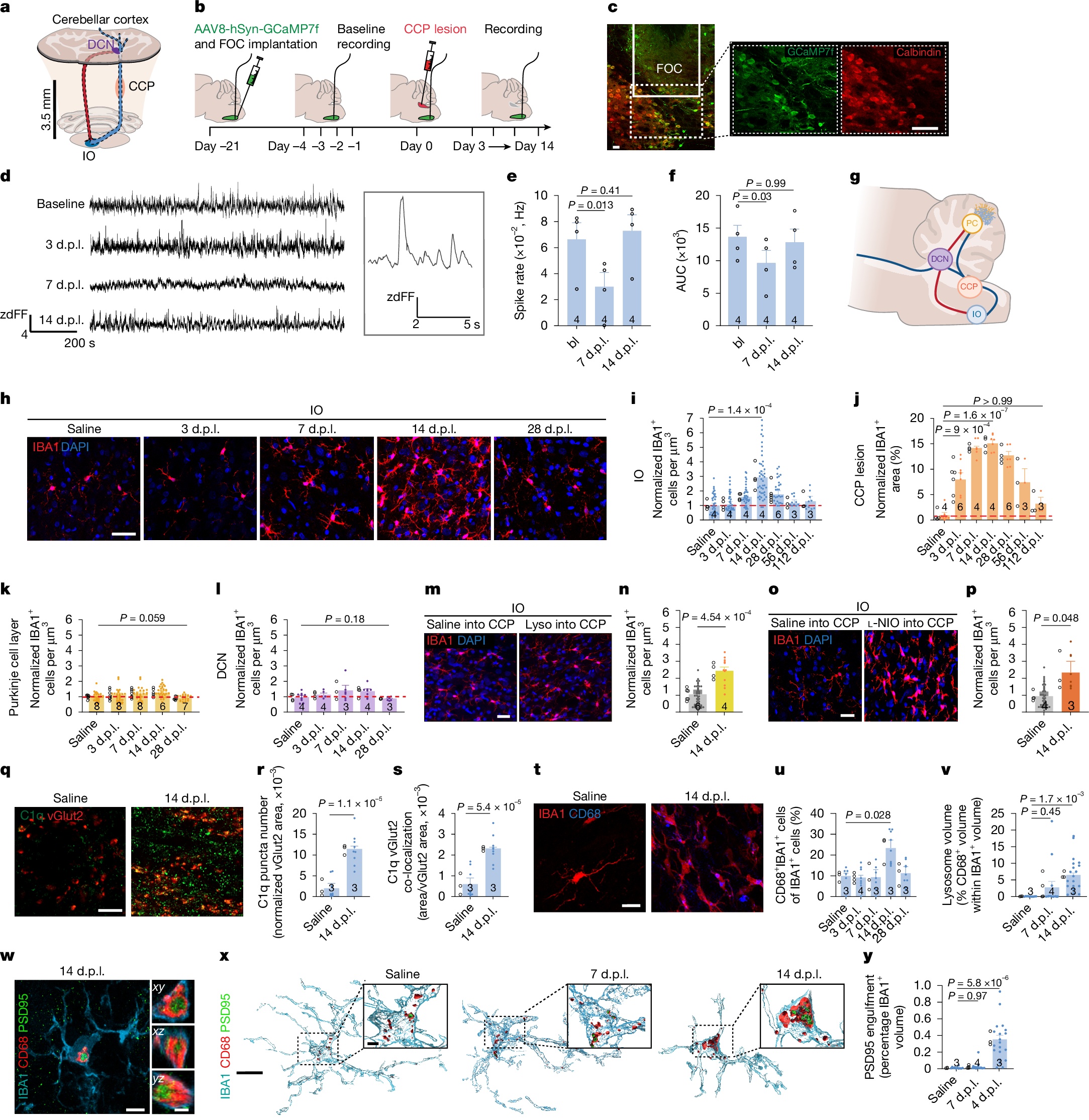 Estudo Inova ao Revelar Lesões da Substância Branca como Impulsores Primários da Neurodegeneração