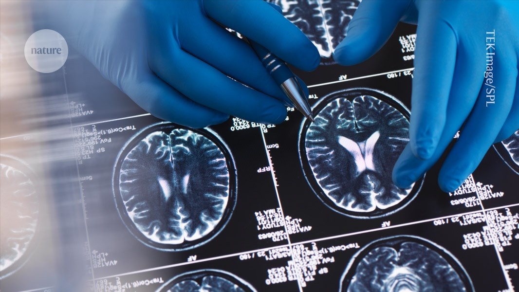 bioRxiv Redefine a Velocidade da Ciência: Como a Neurociência Lidera a Nova Era da Disseminação do Conhecimento
