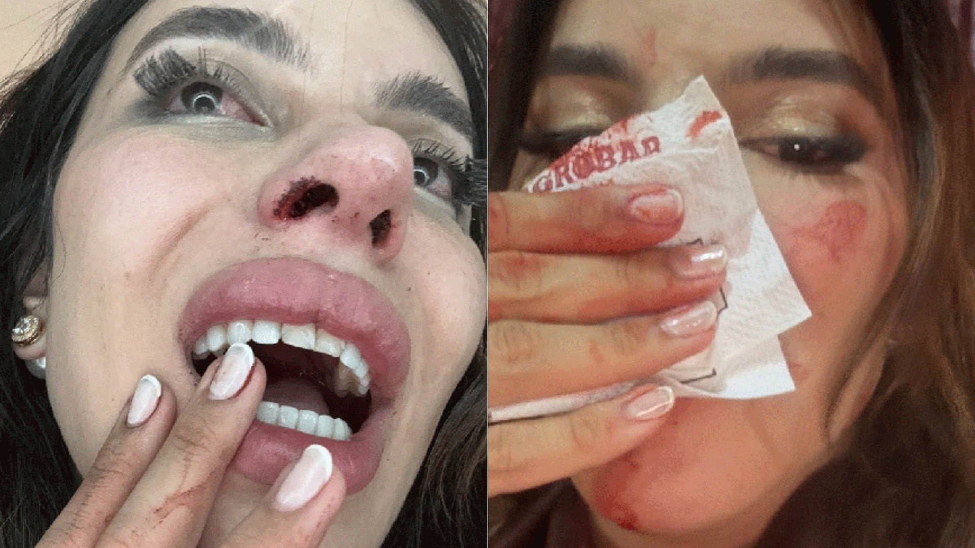 Agressão a Influenciadora Trans no Maranhão: Entenda o Impacto da Violência e a Resposta Legal em Debate