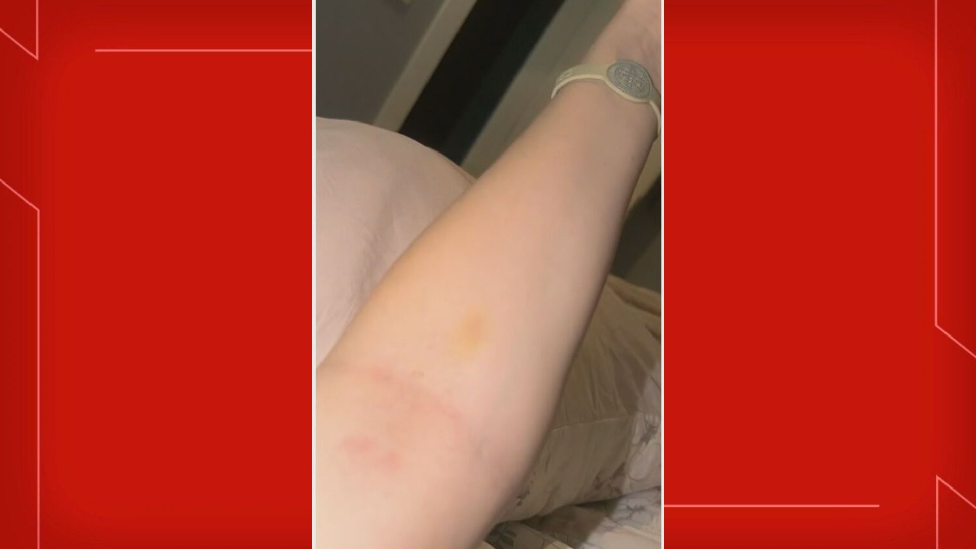 Segurança Feminina em Questão: O Caso de Abuso no Setor de Clubes Sul e o Alerta Regional