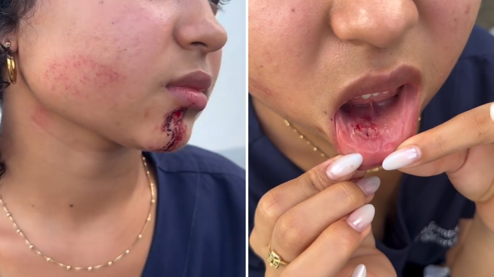 A Insegurança Velada: Agressão em Ônibus em São Luís Revela Desafios Críticos na Mobilidade Urbana