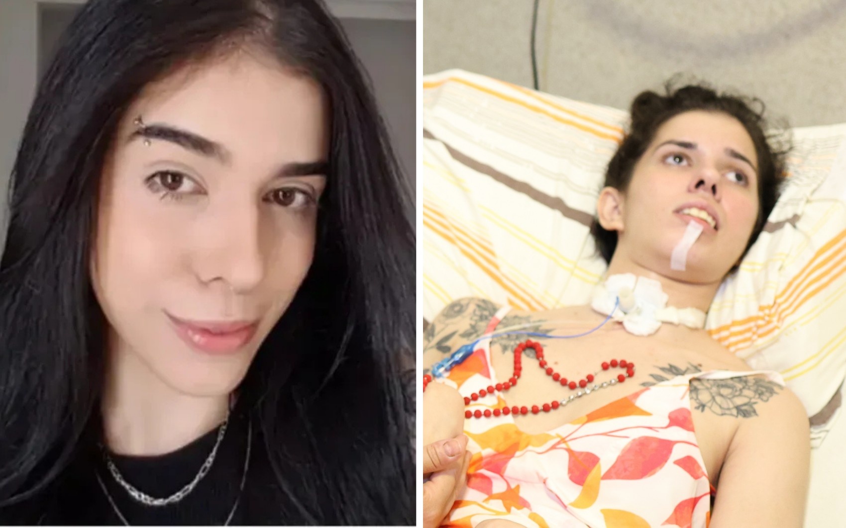 A Recorrência no Caso Thaís Medeiros: Um Alerta Crítico sobre a Complexidade do Cuidado Domiciliar em Goiás