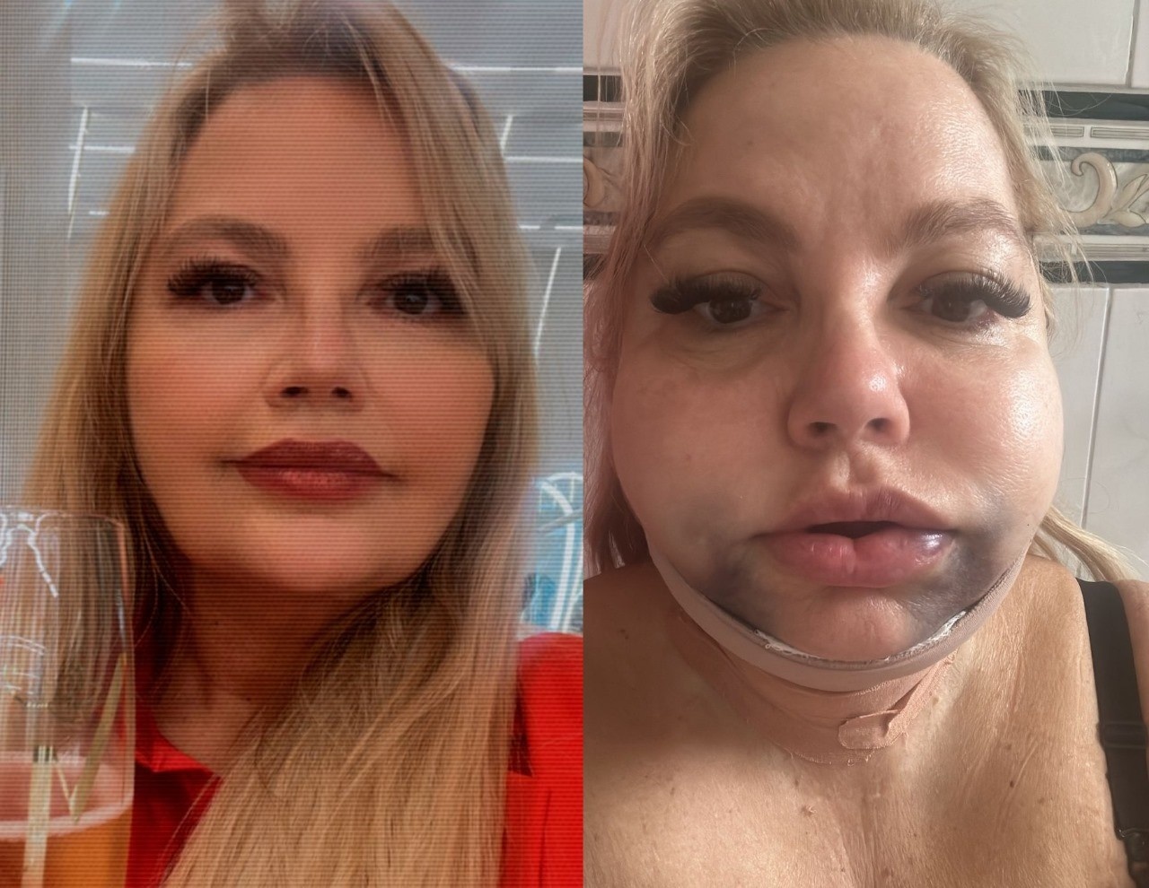 Justiça do Rio Intensifica Ações Contra Dentista Ré, Impondo Tornozeleira e Proibição de Saída do País