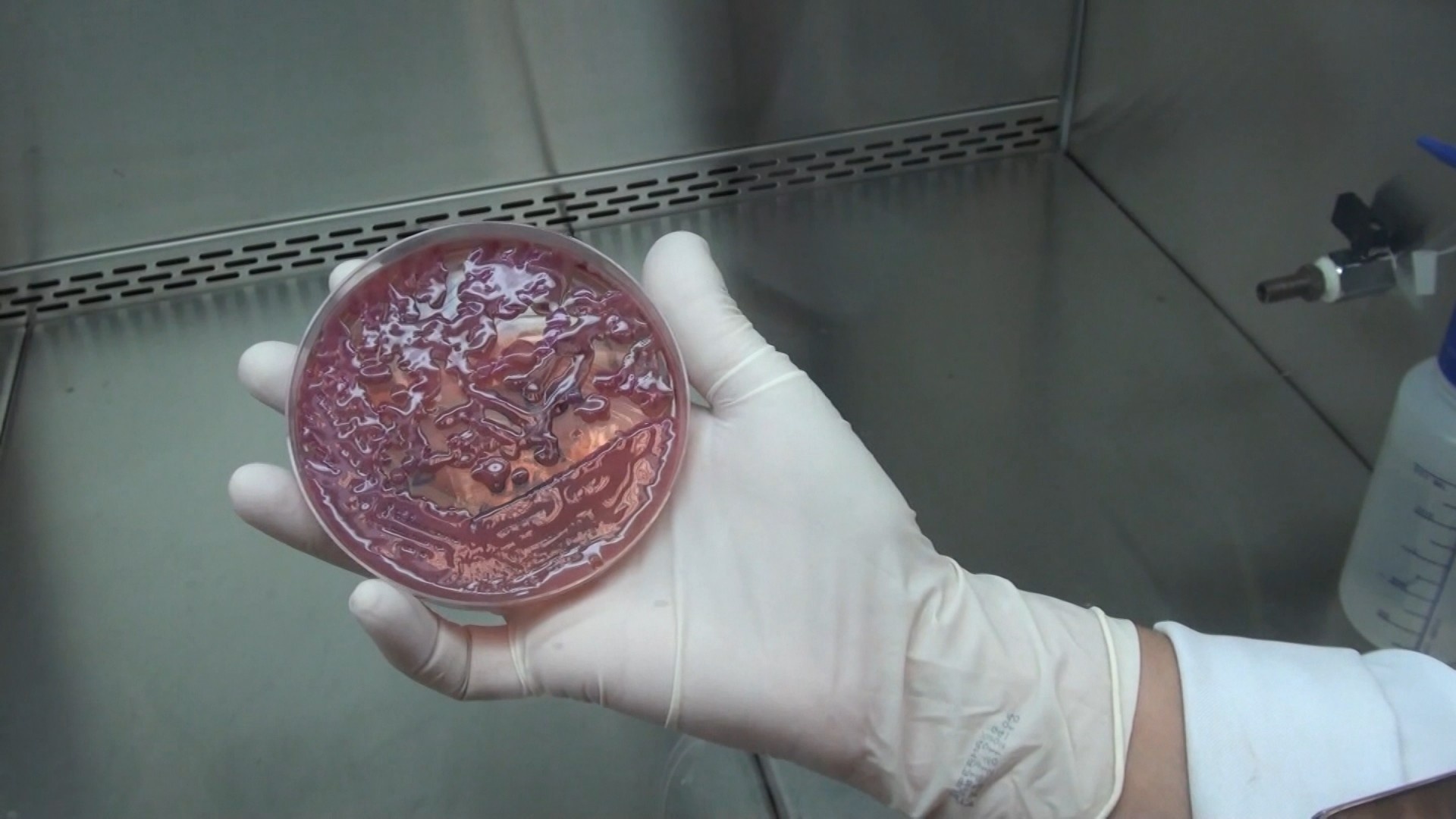 A Superbactéria KPC: Ameaça Silenciosa que Esvazia UTIs e Desafia a Medicina Moderna