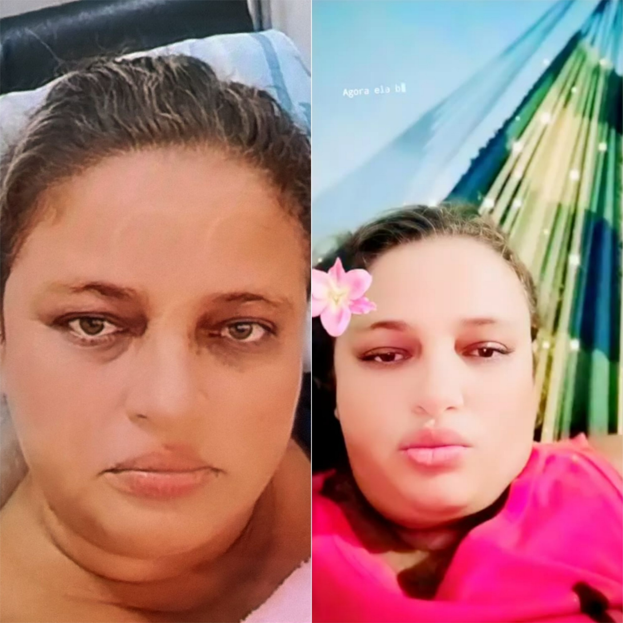 Crise na Diálise de Mossoró: O Impacto Profundo da Interrupção de Tratamento Vital na Saúde Regional