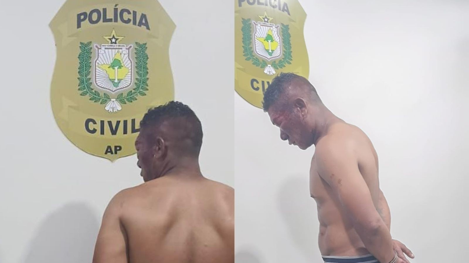 Femicídio em Macapá: A Tragédia Individual que Expõe Fendas Crônicas na Rede de Proteção à Mulher