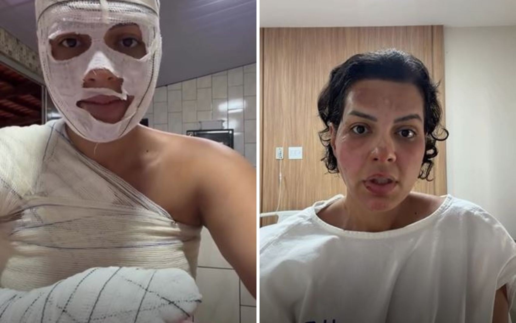 Acidentes Domésticos: A Tragédia Oculta na Rotina e o Alerta Vital para Sua Segurança