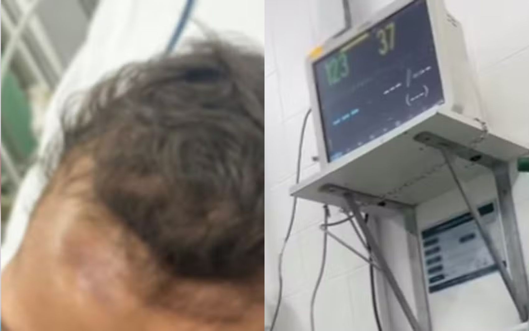 Segurança Hospitalar em Aracaju: Incidente com Bebê Acende Alerta para a Saúde Pública Regional