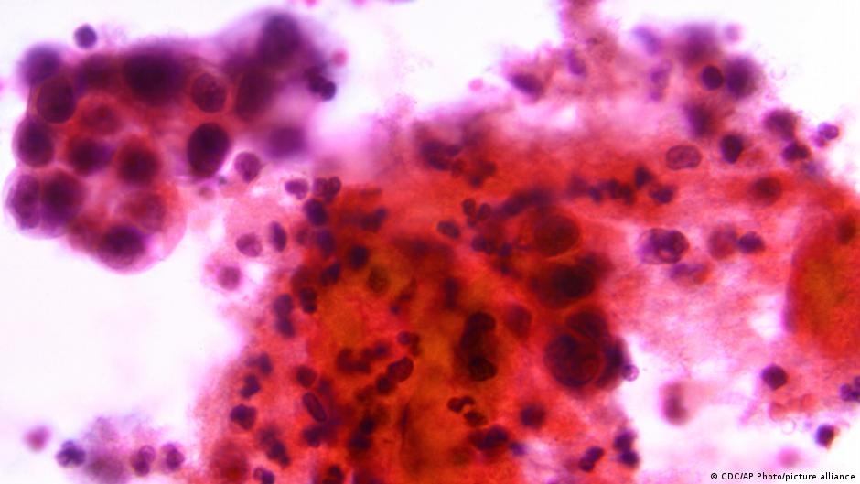 Envelhecimento Biológico Acelerado: A Nova Fronteira na Prevenção do Câncer Precoce