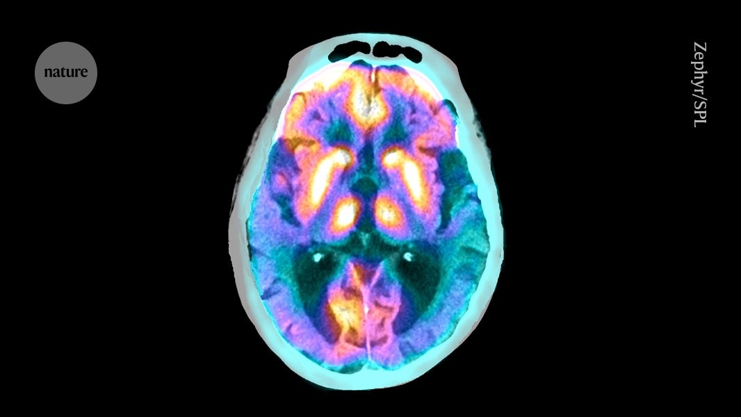 Células cerebrais especializadas podem ser chave para remover proteínas do Alzheimer